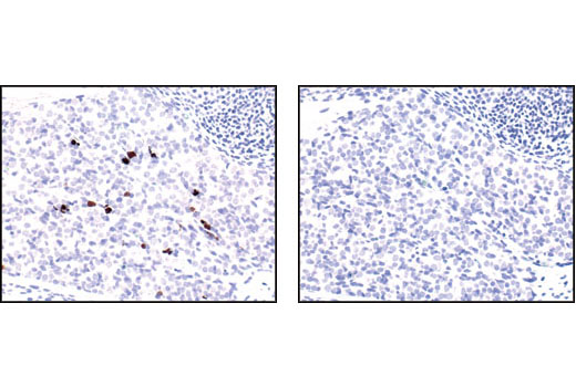 CST   Cleaved Caspase-3 (Asp175) (5A1E) Rabbit mAb  9664S 9664L 9664T