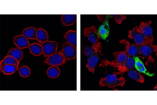 CST   Cleaved Caspase-3 (Asp175) (5A1E) Rabbit mAb  9664S 9664L 9664T