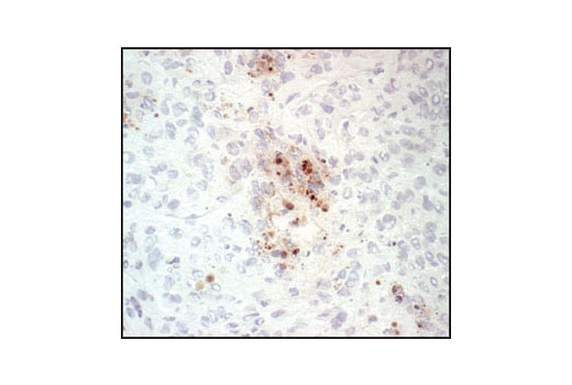 CST   Cleaved Caspase-3 (Asp175) (5A1E) Rabbit mAb  9664S 9664L 9664T