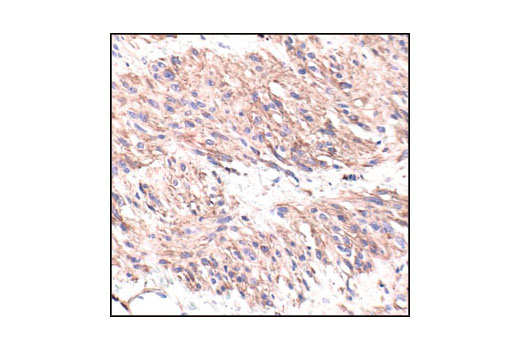 CST   beta-Actin (13E5) Rabbit mAb  4970S 4970L 4970T