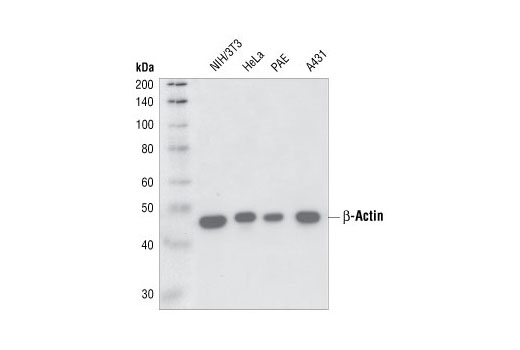 CST   beta-Actin (13E5) Rabbit mAb  4970S 4970L 4970T