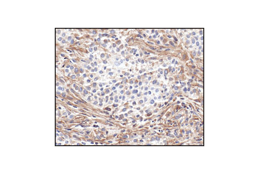 CST   beta-Actin (13E5) Rabbit mAb  4970S 4970L 4970T