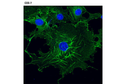 CST   beta-Actin (13E5) Rabbit mAb  4970S 4970L 4970T