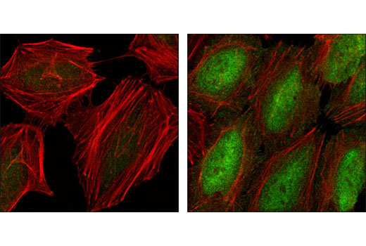 CST   Phospho-NF-kappaB p65 (Ser536) (93H1) Rabbit mAb  3033S 3033L 3033T