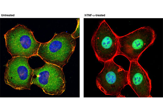 CST   NF-kappaB p65 (D14E12) XP ® Rabbit mAb   8242S  8424T