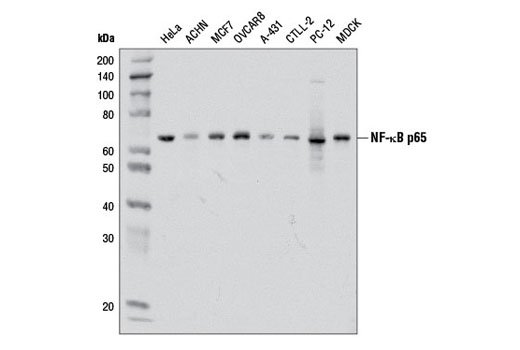 CST   NF-kappaB p65 (D14E12) XP ® Rabbit mAb   8242S  8424T