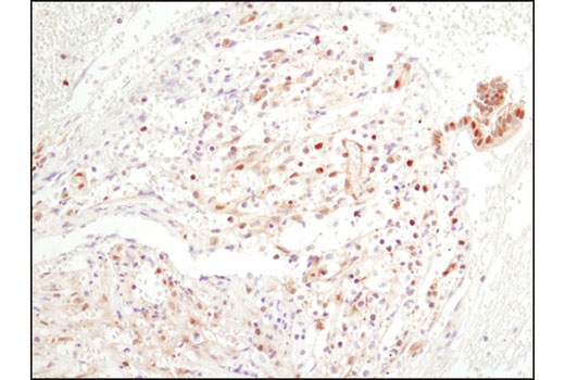 CST   NF-kappaB p65 (D14E12) XP ® Rabbit mAb   8242S  8424T